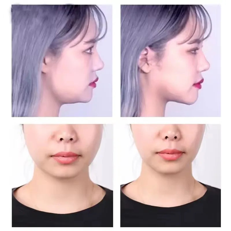 Velori V-Lift Tape — Invisible Face Lifting Stickers for Sagging Skin